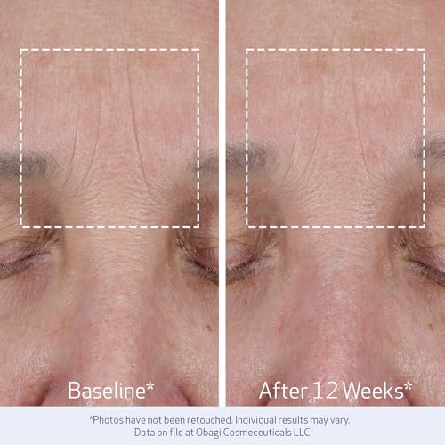 Obagi ELASTIderm Lift Up & Sculpt Facial Moisturizer – Clinically Proven Anti-Aging Face Cream that Visibly Firms & Sculpts Facial Contours, & Reduces Fine Lines & Wrinkles with Peptides – 1.7 oz : Beauty & Personal Care - Image 33