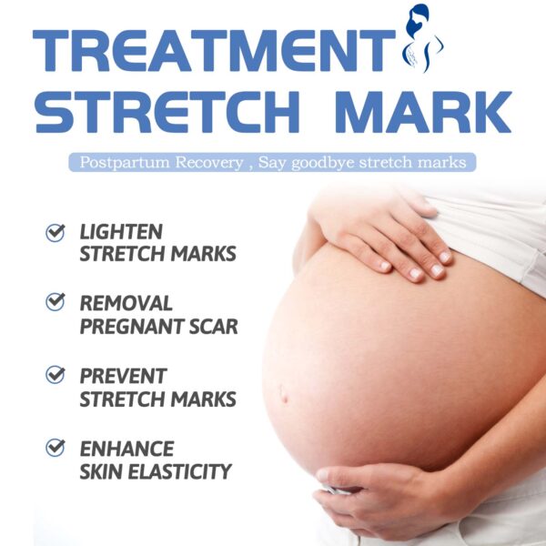 Jaysuing Pregnancy Cream, Postpartum Skin Care Smoothing, Firming And Gently Improving Skin Body Cream - Image 4