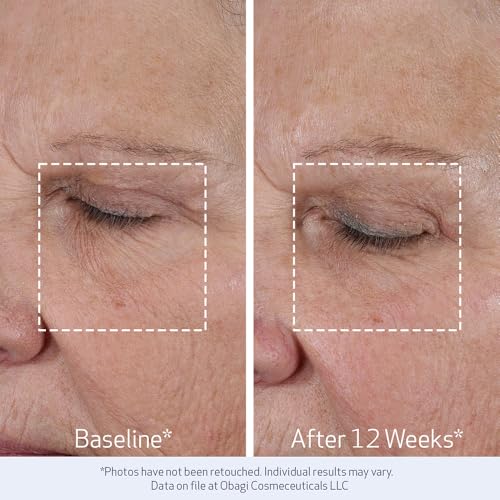 Obagi ELASTIderm Lift Up & Sculpt Facial Moisturizer – Clinically Proven Anti-Aging Face Cream that Visibly Firms & Sculpts Facial Contours, & Reduces Fine Lines & Wrinkles with Peptides – 1.7 oz : Beauty & Personal Care - Image 32