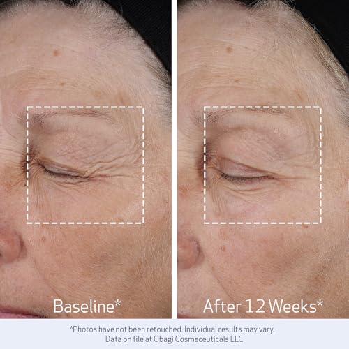 Obagi ELASTIderm Lift Up & Sculpt Facial Moisturizer – Clinically Proven Anti-Aging Face Cream that Visibly Firms & Sculpts Facial Contours, & Reduces Fine Lines & Wrinkles with Peptides – 1.7 oz : Beauty & Personal Care - Image 4