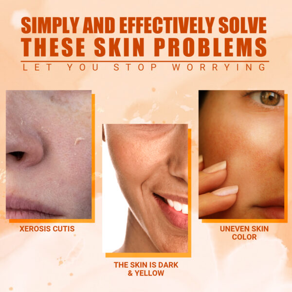 Vitamin C Moisturizing Spray Hydrates And Moisturizes Skin, Lightening Acne Spots And Whitening Spray - Image 4